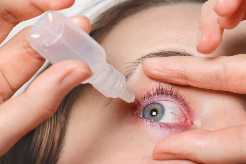 An actionable guide on lasik eye